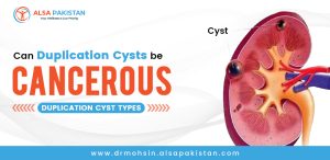 duplication cyst types